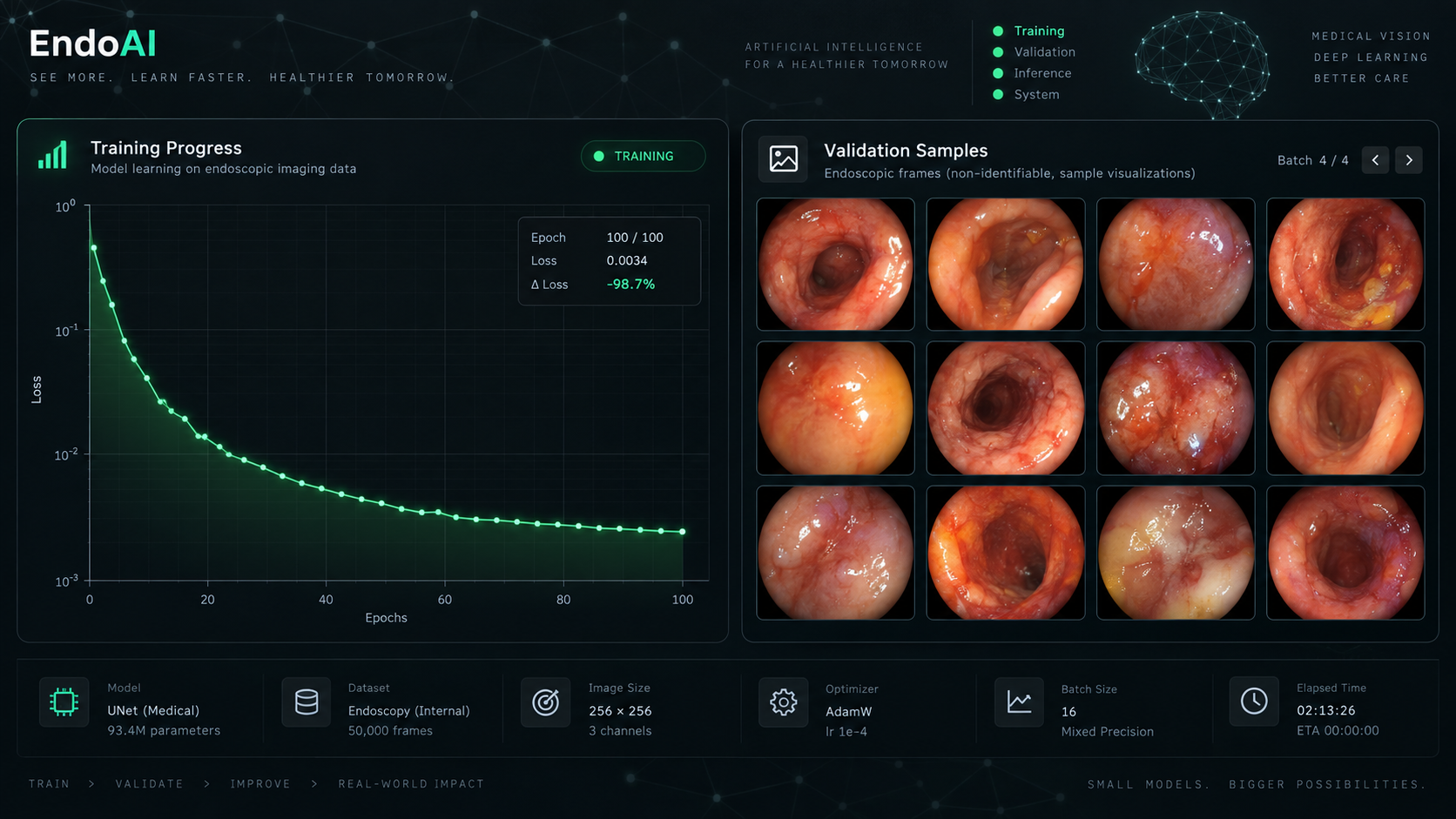 Training loss curve on a medical imaging fine-tune run